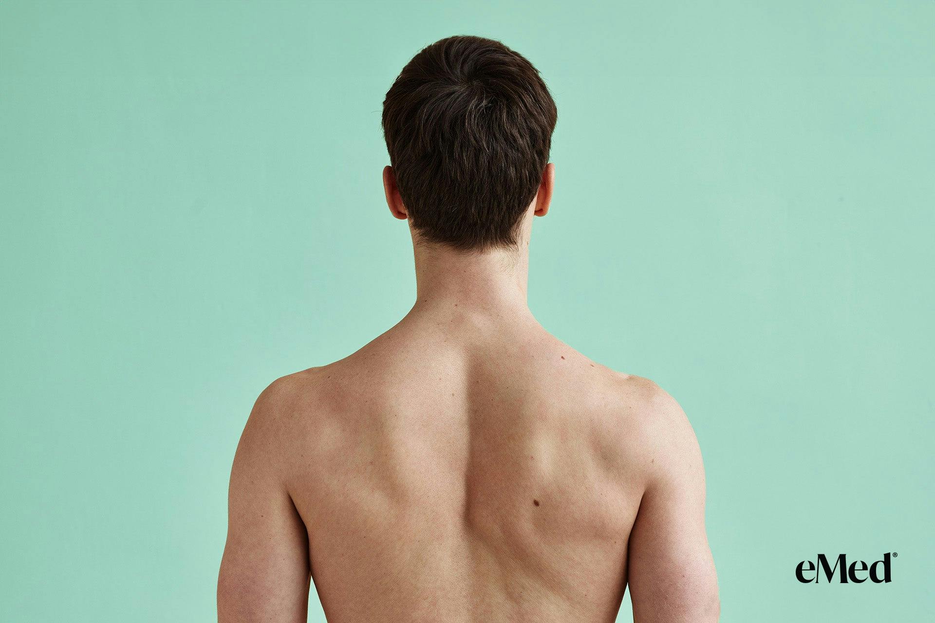 Understanding and Treating Upper Back Pain with Physiotherapy